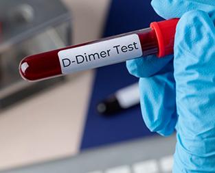 blog/d-dimer-test