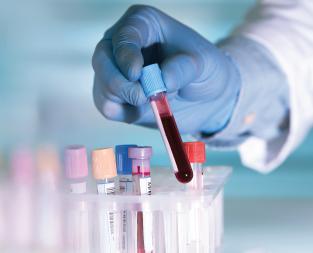 blog/what-is-a-creatinine-test