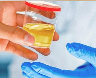 blog/urinalysis